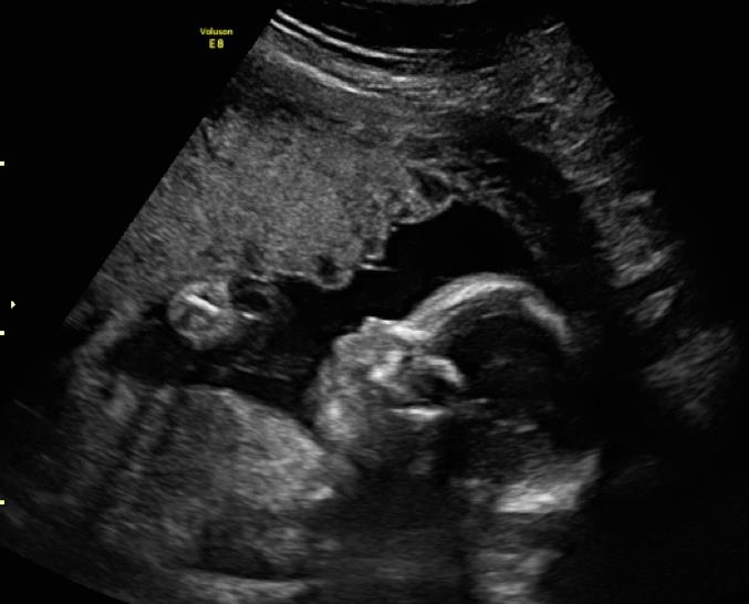 Having a baby - in like, 5 seconds image